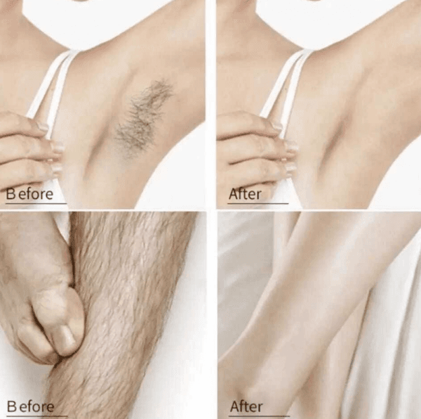 Beauty & health · V13-RU-015641